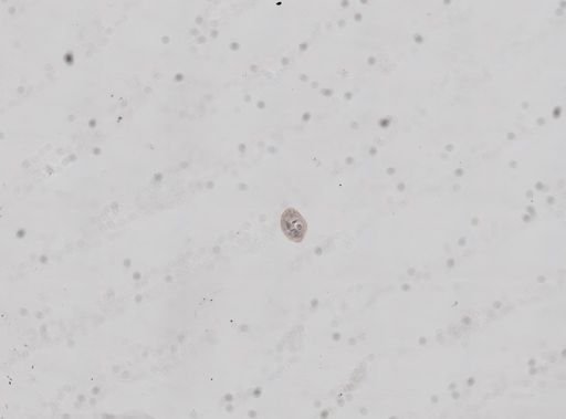 Lineus sanguineus