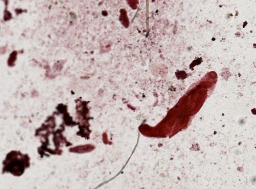 Fasciola hepatica