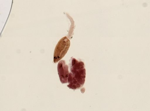 Digenea
