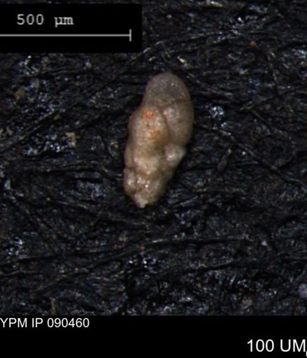 Verneuilina canadensis