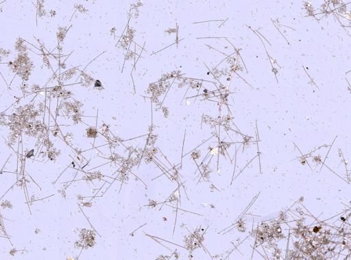 Suberites sp.