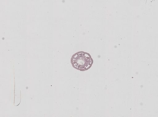 Nematostella