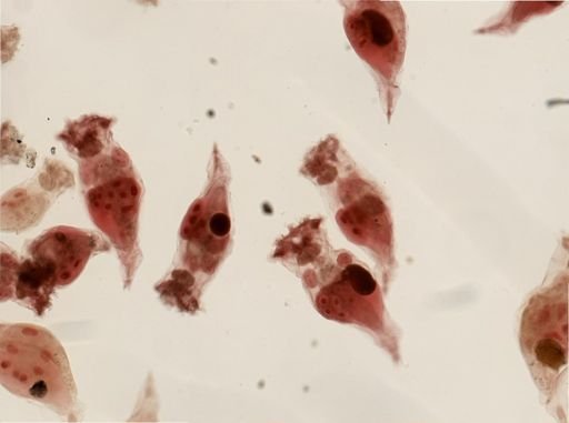 Epiphanes senta