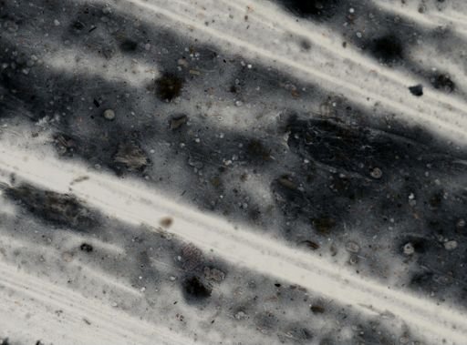 Entamoeba coli