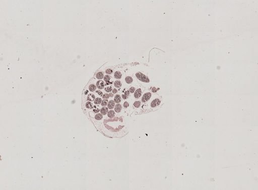 Plasmodium falciparum