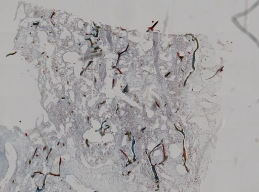 Halichondria sp.