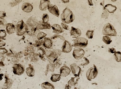 Noctiluca scintillans