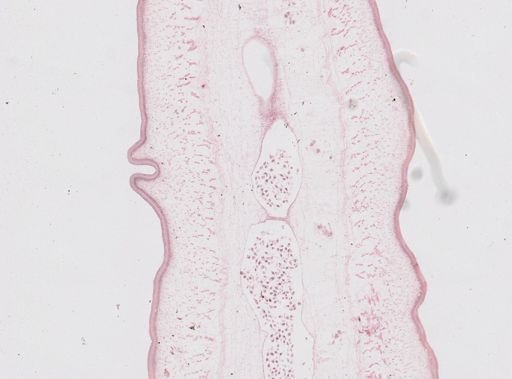 Taenia saginata