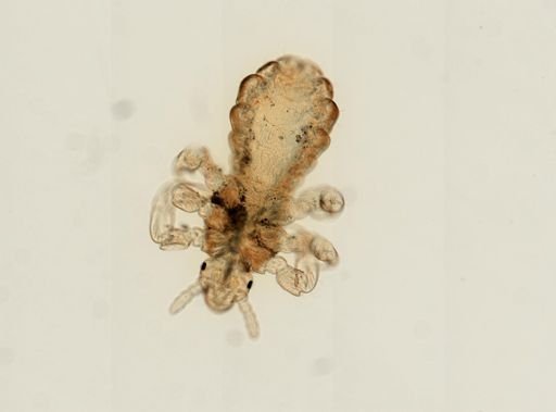 Pediculus humanus