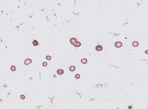 Edwardsia sp.