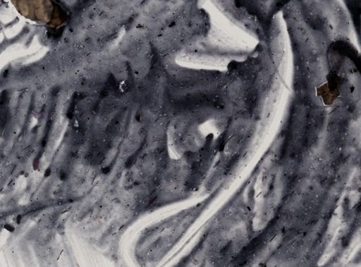 Entamoeba histolytica