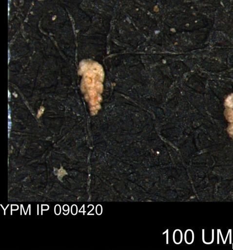 Verneuilina canadensis