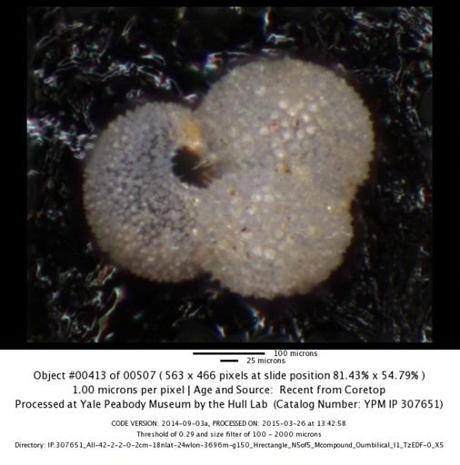 Globigerinoides ruber