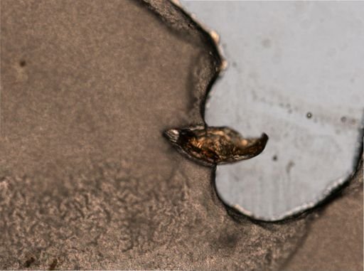 Trichocerca