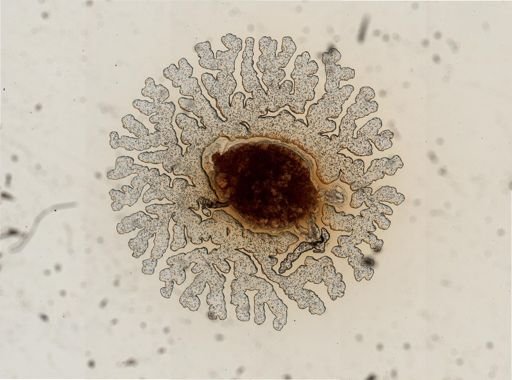 Daktulosphaira vitifoliae