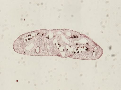 Dicrocoelium dendriticum