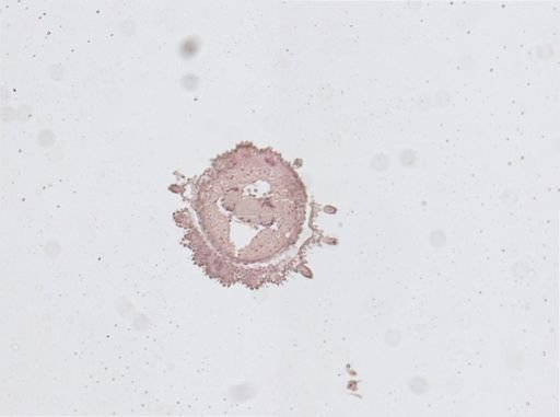 Plicatoperipatus jamaicensis