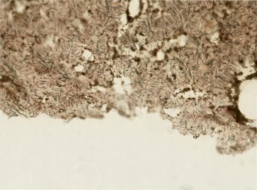 Agelas sp.