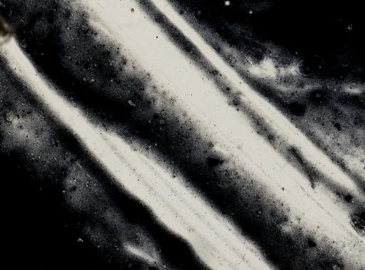 Entamoeba histolytica