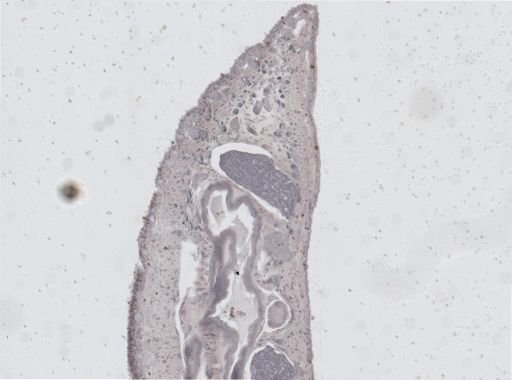 Glossiphonia