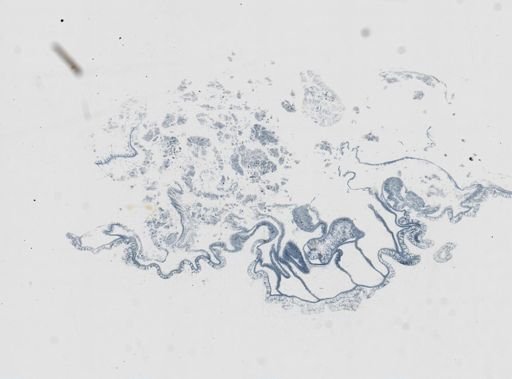 Astrangia poculata