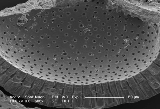 Globorotalia inflata