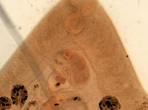 Fasciola hepatica