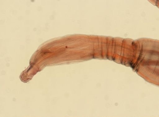 Oligacanthorhynchus microcephalus