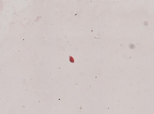 Gastrostyla