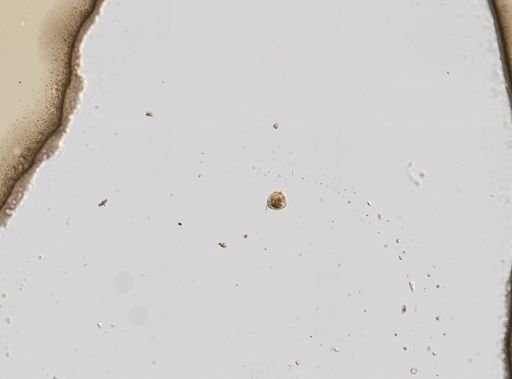 Lecane closterocerca