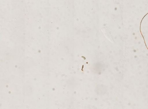 Paramecium
