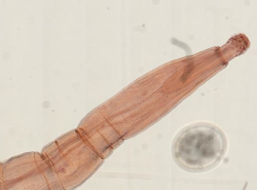 Oligacanthorhynchus microcephalus