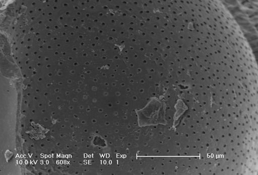 Globorotalia inflata
