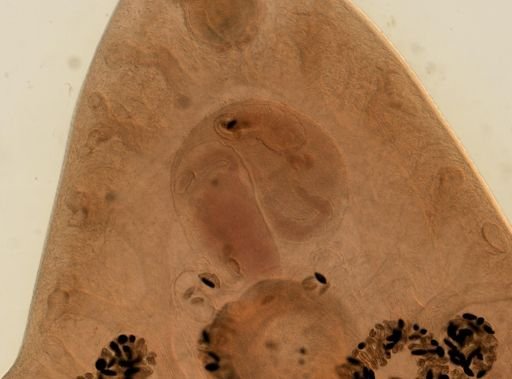 Fasciola hepatica