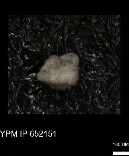 undet. Foraminiferida