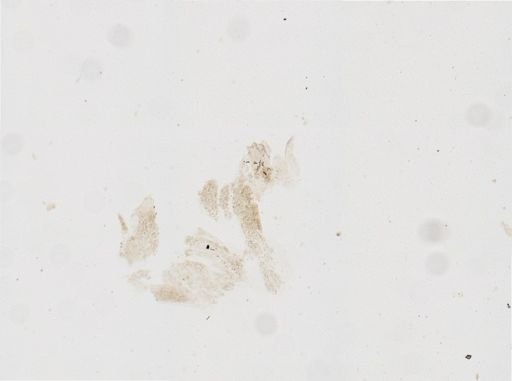 Licnophora?