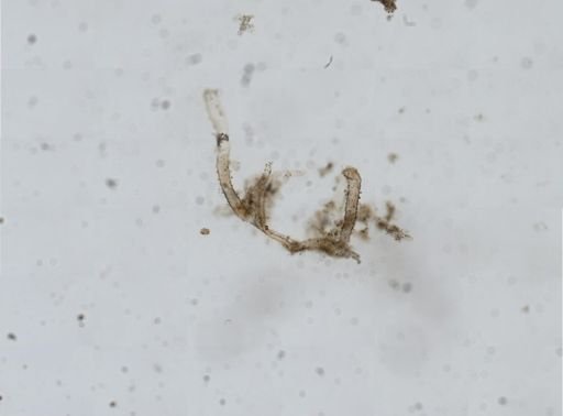 Aetea sica
