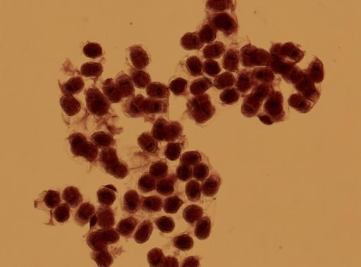 Echinococcus granulosus