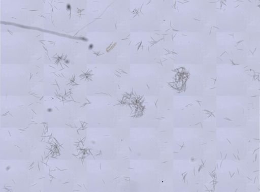 Haliclona oculata