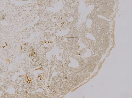 Dysidea variabilis