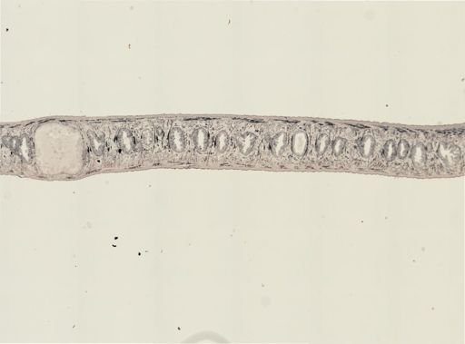 Turbellaria