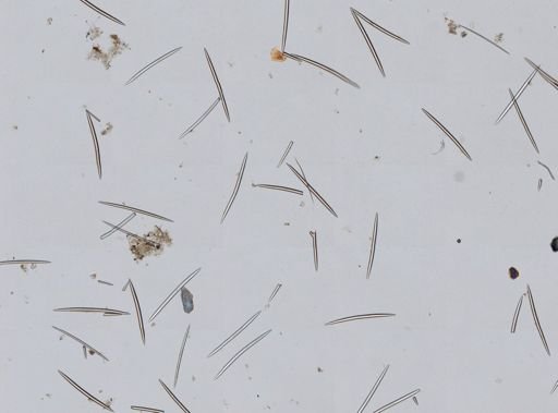 Haliclona