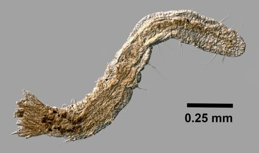 Manayunkia speciosa