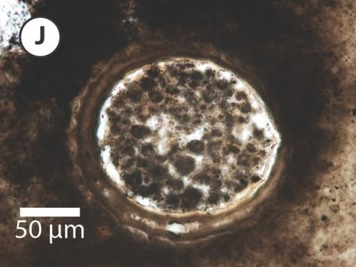 Megasphaera miniscula
