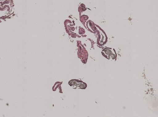 Crepidula convexa