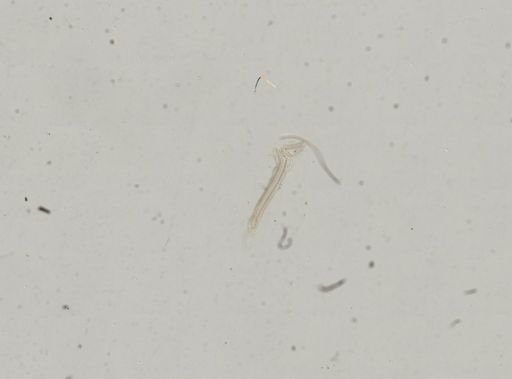 Bythinella viridis