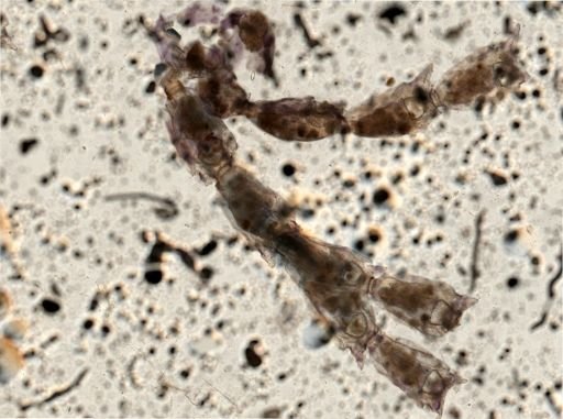 Costaticella solida?
