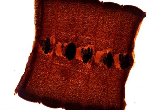 Diphyllobothrium erinacei