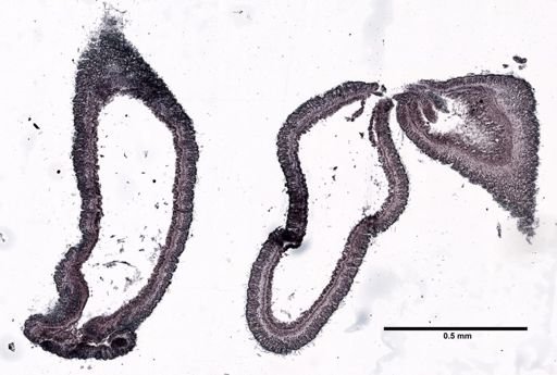 Metridium