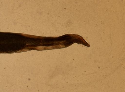 Enterobius vermicularis
